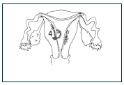 uterus lining